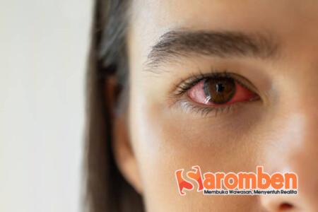 Mata Merah
