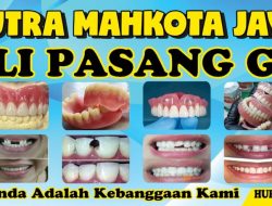 Ahli Gigi Putra Jaya, Hadirkan Layanan Gigi Palsu Berkualitas di Tabalong