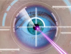 Operasi LASIK: Cara Cepat Perbaiki Penglihatan Tanpa Kacamata